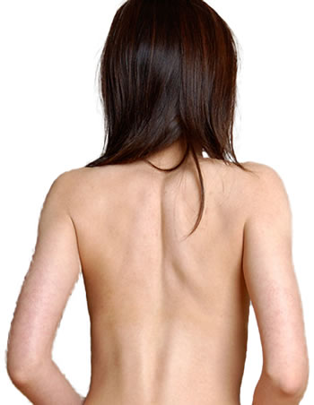 背骨の歪みによる病気の種類